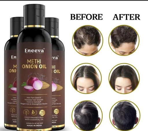  - Onion Methi Hair Oil / Proffesional Ultra Herbal Oil