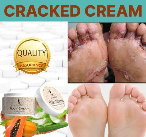 Smartdrops Chapped Hand And Foot Cream Crack Peeling Repair Anti Dry Skin Remove  Dead Skin Foot Moisturizing (50gm) (For Women and men) Pack of 4