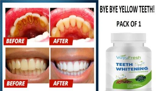 Checkout this latest Teeth Whitening
Product Name: *VAYUFRESH TEETH WHITENING POWDER FOR TEETH*
Product Name: VAYUFRESH TEETH WHITENING POWDER FOR TEETH
Multipack: 1
Country of Origin: India
Easy Returns Available In Case Of Any Issue


SKU: 08 VAYUFRESH TEETH POWDER 100GMS = PACK OF (1)
Supplier Name: JIVA ENTERPRISE

Code: 38-50706392-941

Catalog Name: VAYUFRESH Classy Teeth Whitening 
CatalogID_12713130
M07-C22-SC1872