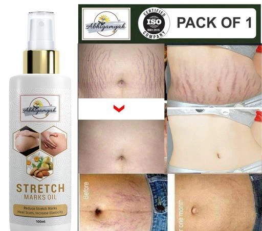 Checkout this latest Stretch Marks And Scars Creams & Oils
Product Name: *abhigamyah present Repair Stretch Marks Removal - Natural Heal Pregnancy Breast, Hip, Legs, Mark oil 100 ml pack of 1*
Product Name: abhigamyah present Repair Stretch Marks Removal - Natural Heal Pregnancy Breast, Hip, Legs, Mark oil 100 ml pack of 1
Brand Name: Abhigamyah
Type: Liquid
Skin Type: All Skin Types
Flavour: Almond
Multipack: 1
Country of Origin: India
Easy Returns Available In Case Of Any Issue


Catalog Name: ABHIGAMYAH Classic Stretch Marks And Scars Creams & Oils
CatalogID_16877775
Code: 000-63474628

.