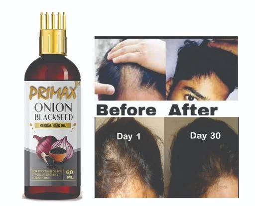  - Primax Onion Fast Hair Growth Oil With Comb Applicator / Primax