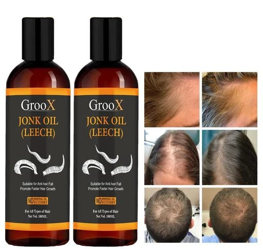 Chamit Organic Red Onion Hair Oil Anti Hair FallGrowth and Stress Relief  Men and Women  100 ml  JioMart