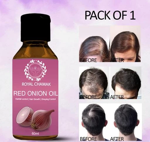  - Royal Chamak Red Onion Hair Oil For Hair Growth Controls Dandruff