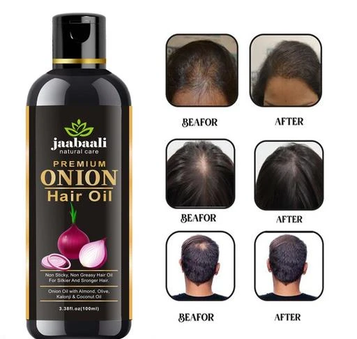  - Jaabaali Onion Fast Hair Growth Oil 100ml / Advanced Soothing  Hair